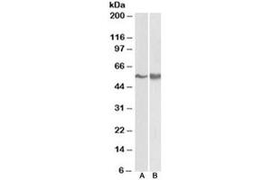 Western blot testing of A431 [A] and Jurkat lysate [B] with FYN antibody at 0. (FYN antibody)