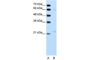 WB Suggested Anti-RGS4 Antibody Titration: 0. (RGS4 antibody  (C-Term))