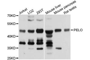 Western blot analysis of extracts of various cells, using PELO antibody.