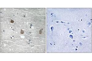 Immunohistochemistry analysis of paraffin-embedded human brain, using TOB1 (Phospho-Ser164) Antibody. (Protein Tob1 (TOB1) (AA 130-179), (pSer164) antibody)