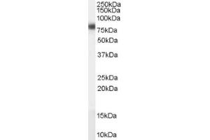 Image no. 1 for anti-Carnitine Palmitoyltransferase 1A (Liver) (CPT1A) (Internal Region) antibody (ABIN374737) (CPT1A antibody  (Internal Region))