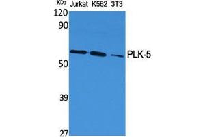 Western Blot (WB) analysis of specific cells using PLK-5 Polyclonal Antibody.
