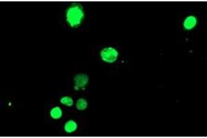 Image no. 3 for anti-T-Cell Acute Lymphocytic Leukemia 1 (TAL1) antibody (ABIN1501295) (TAL1 antibody)