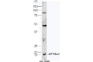 Immunofluorescence (Paraffin-embedded Sections) (IF (p)) image for anti-Ionized Calcium-binding Adapter Molecule 1 (IBA1) (AA 51-147) antibody (ABIN685477)