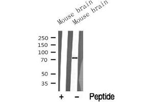 Western blot analysis of extracts of Mouse brain tissue sample,using NuaK1 Antibody(ABIN6272814). (NUAK1 antibody  (C-Term))