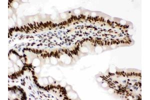 IHC analysis of RbAp48 using anti-RbAp48 antibody (ABIN3043920). (Retinoblastoma Binding Protein 4 antibody  (C-Term))