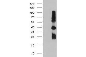 TIMP2 antibody