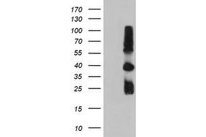 Western Blotting (WB) image for anti-Metalloproteinase Inhibitor 2 (TIMP2) antibody (ABIN1501393) (TIMP2 antibody)