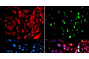 Immunofluorescence analysis of GFP-RNF168 transgenic U2OS cells using UIMC1 Polyclonal Antibody (UIMC1 antibody)