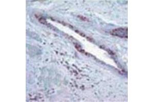 Image no. 2 for anti-Retinoblastoma Protein (Rb Protein) (Cleavage Site) antibody (ABIN207915) (Retinoblastoma Protein (Rb) antibody  (Cleavage Site))