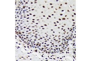 Immunohistochemistry of paraffin-embedded human esophageal using SF3B3/S Rabbit mAb (ABIN7270544) at dilution of 1:100 (40x lens). (SF3B3 antibody)
