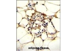 C9JLR9 Antibody (C-term) (ABIN655296 and ABIN2844883) immunohistochemistry analysis in formalin fixed and paraffin embedded human adipose tissue followed by peroxidase conjugation of the secondary antibody and DAB staining. (C11orf95 antibody  (C-Term))