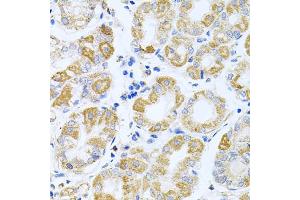 Immunohistochemistry of paraffin-embedded human stomach using IRS1 antibody (ABIN5970075) at dilution of 1/100 (40x lens). (IRS1 antibody)