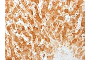 Formalin-fixed, paraffin-embedded human Liver stained with Connexin 32 Monoclonal Antibody (GJB1/1753) (GJB1 antibody)