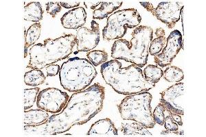 IHC analysis of Hexokinase 1/HK1 using anti-Hexokinase 1/HK1 antibody (ABIN7600258).