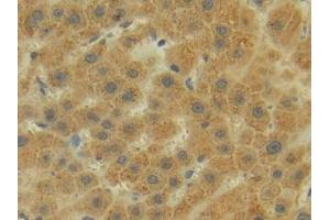 Detection of P-cadherin in Human Liver Tissue using Polyclonal Antibody to Placental Cadherin (P-cadherin) (P-Cadherin antibody  (AA 371-660))