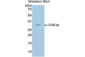 Western Blotting (WB) image for anti-GRB2-Related Adaptor Protein 2 (GRAP2) (AA 20-262) antibody (ABIN3202798)