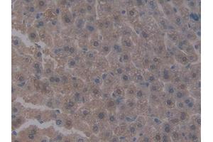 DAB staining on IHC-P; Samples: Mouse Liver Tissue (Integrin beta 5 antibody  (AA 136-378))