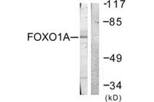 Western blot analysis of extracts from HeLa cells, treated with Serum 20% 15', using FOXO1A (Ab-329) Antibody. (FOXO1 antibody  (AA 295-344))