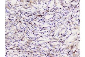 IHC analysis of Caveolin-1/CAV1 using anti-Caveolin-1/CAV1 antibody (ABIN3043803).