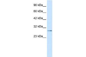 WB Suggested Anti-TBX20 Antibody Titration: 0. (TBX20 antibody  (N-Term))