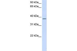 WB Suggested Anti-C21orf91 Antibody Titration:  0. (C21orf91 antibody  (Middle Region))