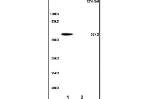 Lane 1: mouse liver lysates Lane 2: rat brain lysates probed with Anti OAT-1/SLC22A6 Polyclonal Antibody, Unconjugated (ABIN670791) at 1:200 overnight at 4 °C.