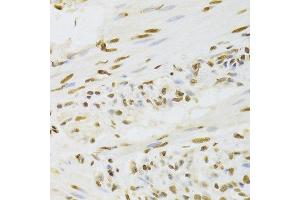 Immunohistochemistry (Paraffin-embedded Sections) (IHC (p)) image for anti-Heterogeneous Nuclear Ribonucleoprotein D (HNRNPD) (AA 1-306) antibody (ABIN6141905)