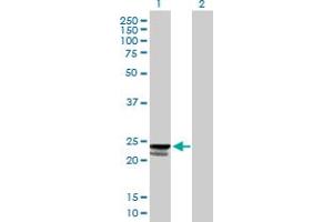 Western Blot analysis of C9orf115 expression in transfected 293T cell line by C9orf115 MaxPab polyclonal antibody. (PTRH1 antibody  (AA 1-214))