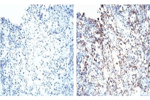 Immunohistochemistry (IHC) image for anti-Von Hippel-Lindau Tumor Suppressor, E3 Ubiquitin Protein Ligase (VHL) (AA 1-213) antibody (ABIN967508) (VHL antibody  (AA 1-213))
