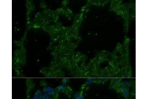 Immunofluorescence analysis of Rat lung using TREM2 Polyclonal Antibody at dilution of 1:100. (TREM2 antibody)