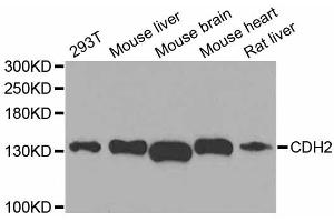Western blot analysis of extracts of various cell lines, using CDH2 antibody (ABIN5995676) at 1/1000 dilution. (N-Cadherin antibody)