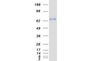 Western Blotting (WB) image for Runt-Related Transcription Factor 1, Translocated To, 1 (Cyclin D-Related) (RUNX1T1) (Transcript Variant 3) protein (Myc-DYKDDDDK Tag) (ABIN2731257)