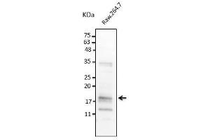 Anti-TNF-α Ab at 1/2,500 dilution, 100 µg of total protein lysate per lane, rabbit polyclonal to goat lgG  (HRP) at 1/10,000 dilution, (TNF alpha antibody)