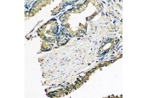 Immunohistochemical analysis of ETFA staining in human prostate formalin fixed paraffin embedded tissue section. (ETFA antibody)