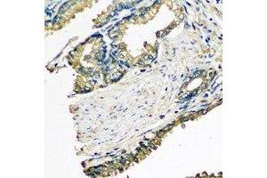Immunohistochemical analysis of ETFA staining in human prostate formalin fixed paraffin embedded tissue section.