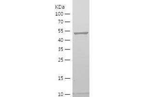 Western Blotting (WB) image for LATS, Large Tumor Suppressor, Homolog 2 (Drosophila) (LATS2) (AA 120-234) protein (His tag) (ABIN7123724) (LATS2 Protein (AA 120-234) (His tag))