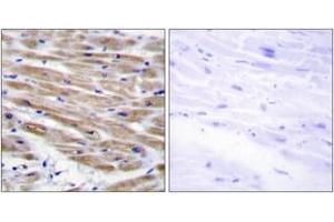 Immunohistochemistry analysis of paraffin-embedded human heart tissue, using MAP3K4 Antibody. (MAP3K4 antibody  (AA 1281-1330))