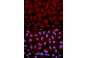 Immunofluorescence analysis of U2OS cells using BCHE antibody (ABIN5970682).