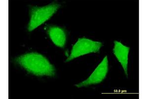 Immunofluorescence of purified MaxPab antibody to ZNFX1 on HeLa cell. (ZNFX1 antibody  (AA 1-1918))