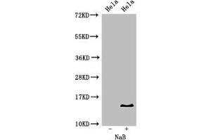 Western Blot Positive WB detected in: Hela cell acid extracts treated by NaB All lanes: HIST1H2BB antibody at 2 μg/mL Secondary Goat polyclonal to rabbit IgG at 1/50000 dilution Predicted band size: 14 kDa Observed band size: 14 kDa (HIST1H2BB antibody  (acLys16))