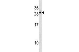 HOXD12 antibody western blot analysis in A549 lysate. (HOXD12 antibody  (AA 211-237))