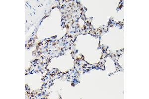 Immunohistochemistry of paraffin-embedded rat lung using SFTP Rabbit pAb (ABIN3017436, ABIN3017437, ABIN3017438 and ABIN6220091) at dilution of 1:50 (40x lens). (Surfactant Protein A1 antibody)