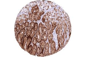 anti-Glutathione Peroxidase 2 (GPX2) antibody