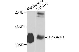 Western blot analysis of extracts of mouse liver and rat liver cell lines, using TP53AIP1 antibody.
