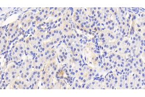 Detection of ACAT1 in Human Kidney Tissue using Polyclonal Antibody to Acetyl Coenzyme A Acetyltransferase 1 (ACAT1) (ACAT1 antibody  (AA 111-427))