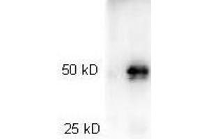 Western Blotting (WB) image for Goat anti-Rabbit IgG (Heavy & Light Chain) antibody (HRP) (ABIN101998) (Goat anti-Rabbit IgG (Heavy & Light Chain) Antibody (HRP))