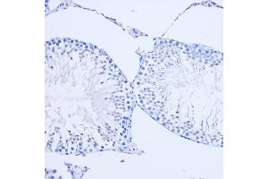 Immunohistochemistry of paraffin-embedded Rat testis using ARX Rabbit pAb (ABIN7265673) at dilution of 1:50 (20x lens). (Arx antibody  (C-Term))