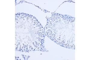 Immunohistochemistry of paraffin-embedded Rat testis using ARX Rabbit pAb (ABIN7265673) at dilution of 1:50 (20x lens). (Arx antibody  (C-Term))