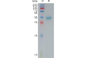 Claudin 4 Protein (CLDN4) (AA 145-157) (mFc Tag)